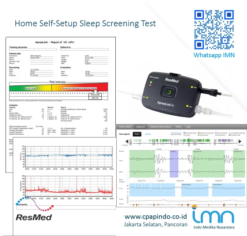 OverNight Sleep Screening Test